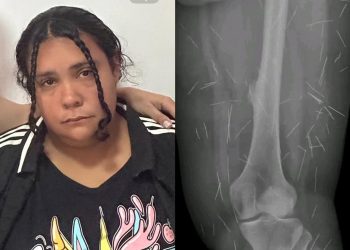 Mulher que fingiu ter 12 anos em SC para ser adotada tinha sido condenada em GO por falsidade ideológica após se passar por criança abusada