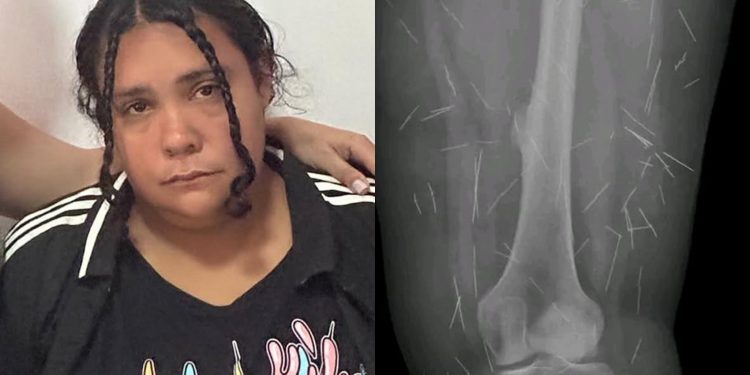 Mulher que fingiu ter 12 anos em SC para ser adotada tinha sido condenada em GO por falsidade ideológica após se passar por criança abusada