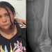 Mulher que fingiu ter 12 anos em SC para ser adotada tinha sido condenada em GO por falsidade ideológica após se passar por criança abusada